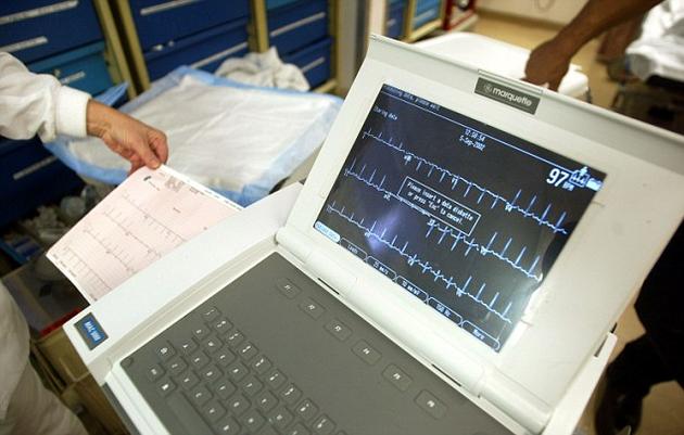 心电图记录装置的资料图。有超过150位志愿者参与了实验,他们被要求感知一个在屏幕上一闪而过的形状。当形状闪过的时间刚好与心跳重合时,志愿者在感知上就会更加困难。